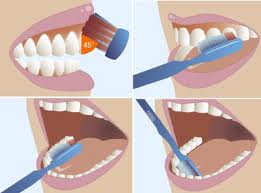 Técnica del Cepillado Dental